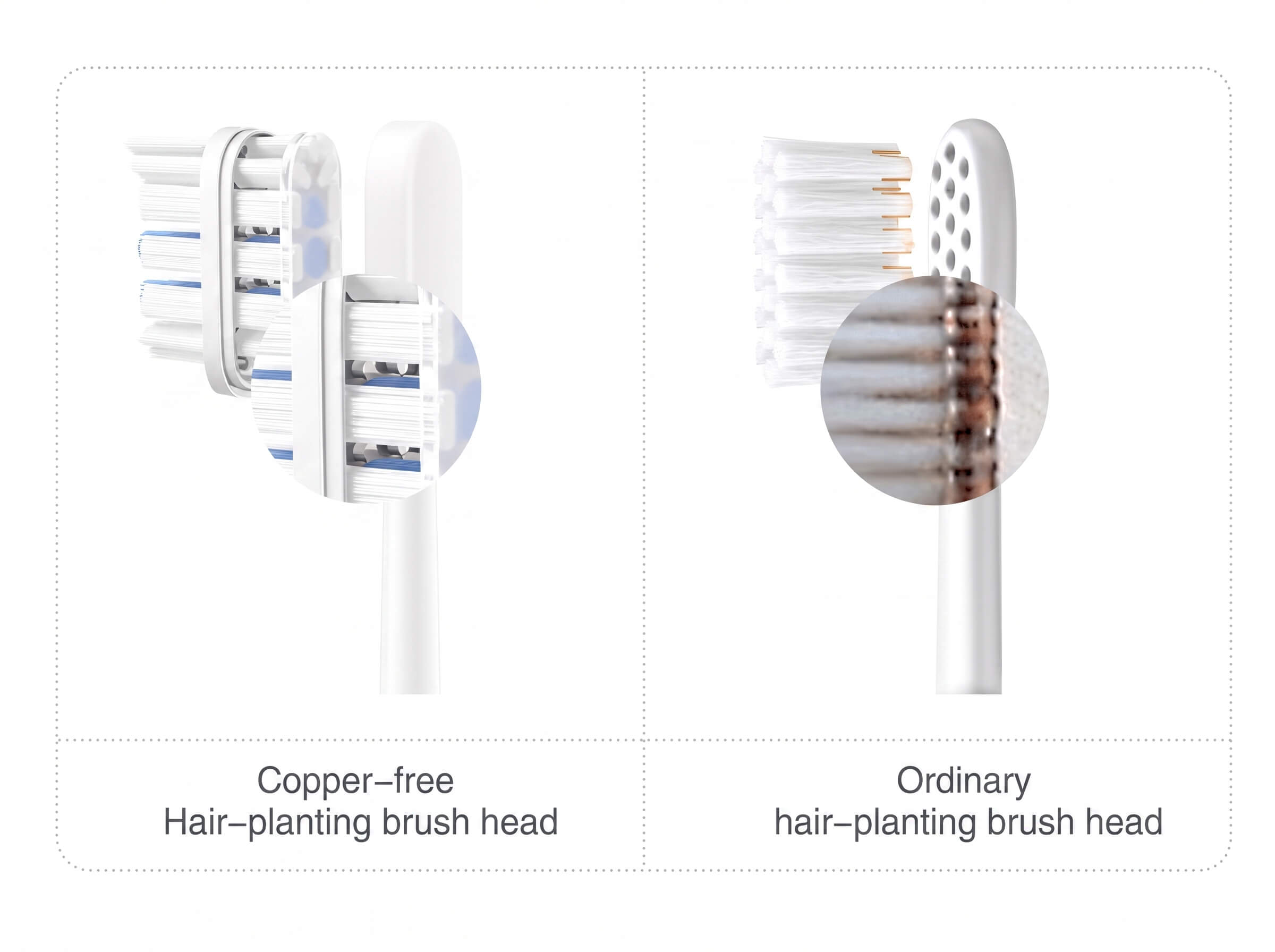 Xiaomi Sonic Electric Toothbrush T301