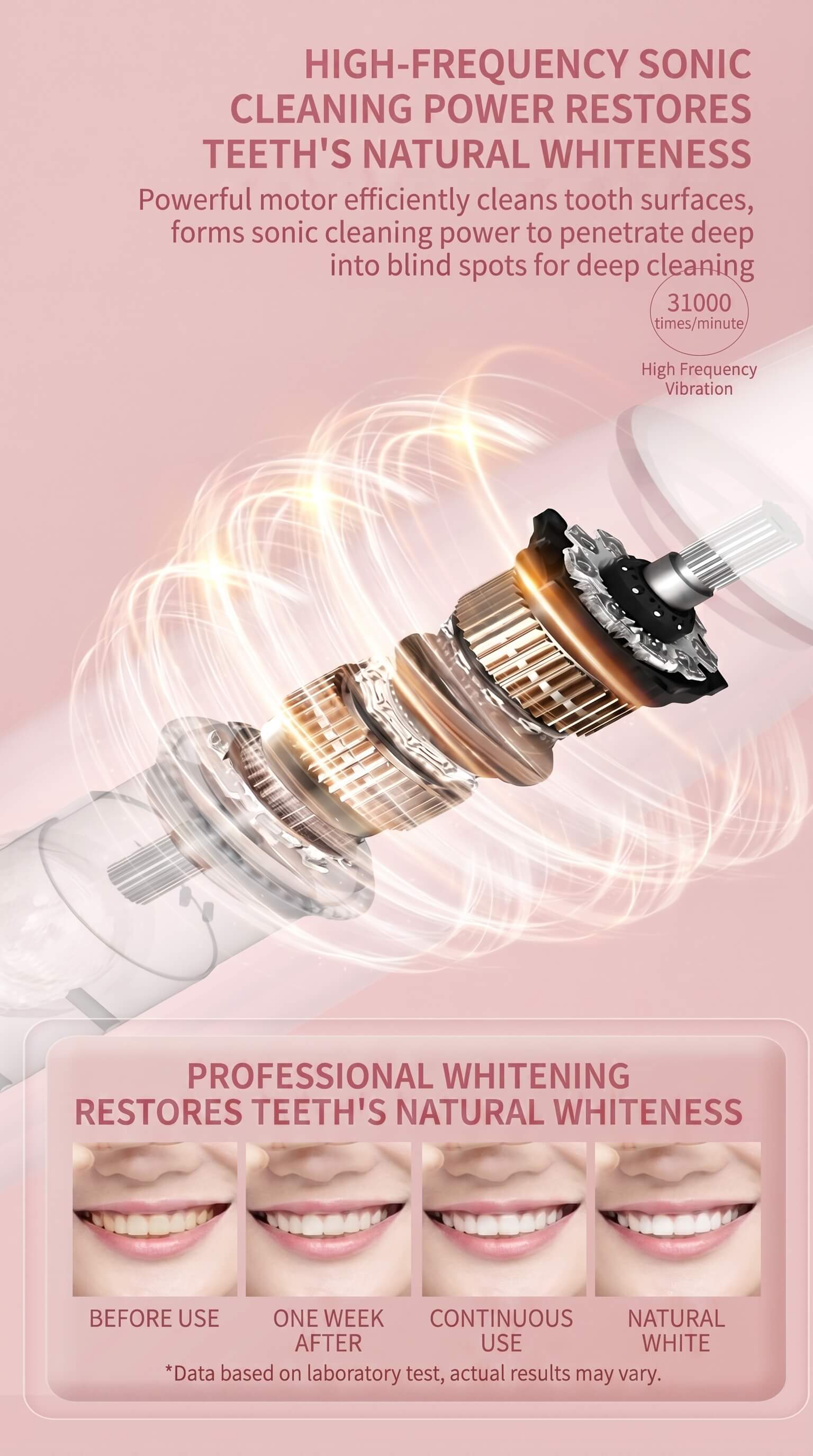 Yingqu Electric Toothbrush
